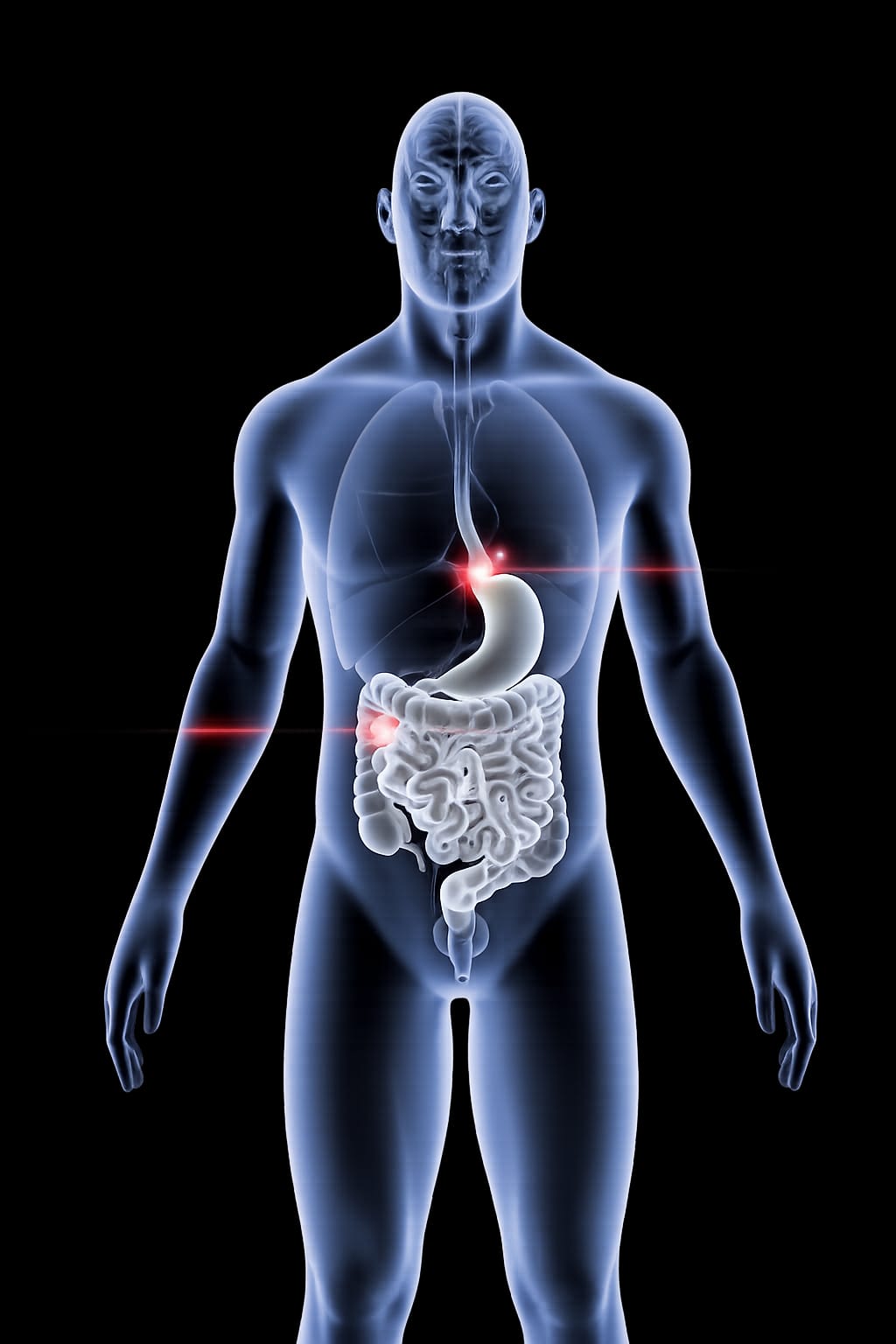 Anatomical illustration showing EGAD target locations in the gastrointestinal tract